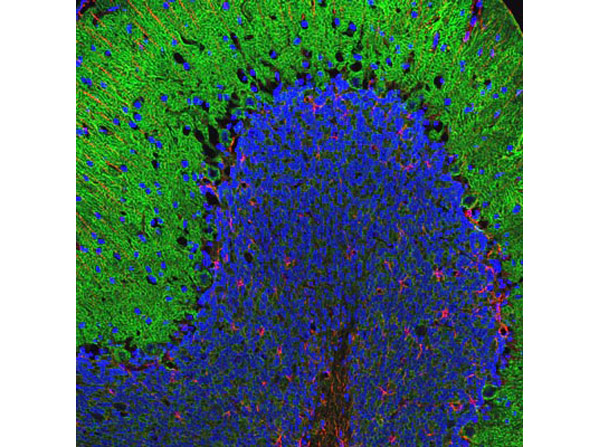 Immunofluorescence with Anti-Alpha-II-Spectrin